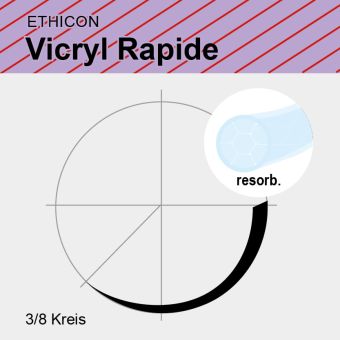 Vicryl Rapide ungef. gefl. USP 5/0 45cm, P1 Multipass 