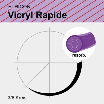 Vicryl Rapide viol. gefl. USP 6/0 45cm, P1 Multipass 